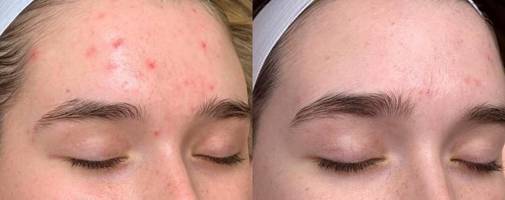 Vitamin A&E Night Cream