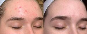 Vitamin A&E Night Cream